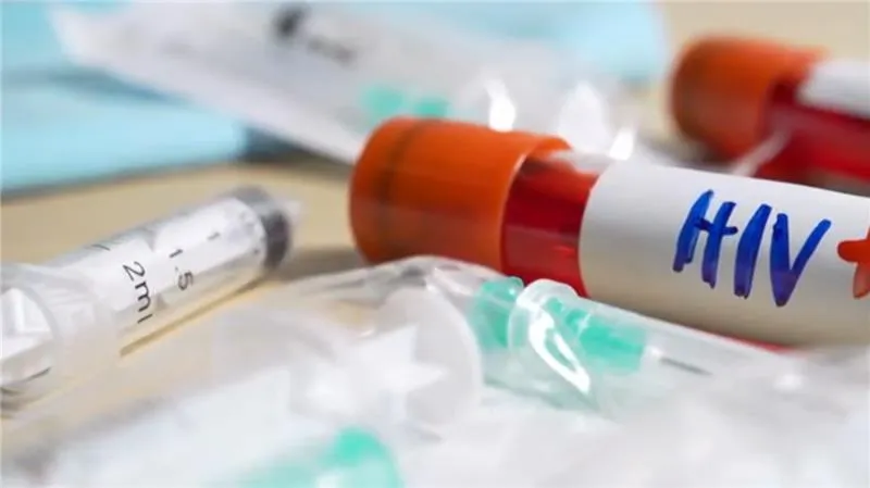 HIV Travel Restrictions in Egypt